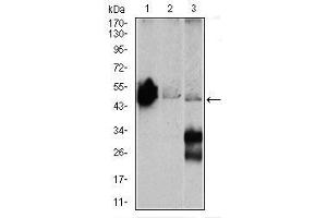 Image no. 1 for anti-Enolase 2 (Gamma, Neuronal) (ENO2) antibody (ABIN1491284) (ENO2/NSE antibody)