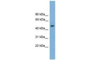Image no. 1 for anti-Nuclear Prelamin A Recognition Factor (NARF) (AA 323-372) antibody (ABIN6745635) (NARF antibody  (AA 323-372))