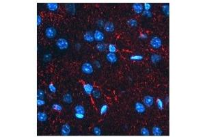 BACE1 antibody used at a concentration of 2-10 ug/ml to detect astrocytes in rodent brain (red). (BACE1 antibody  (N-Term))