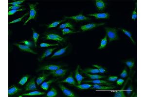 Immunofluorescence of purified MaxPab antibody to UQCRC2 on HeLa cell. (UQCRC2 antibody  (AA 1-453))