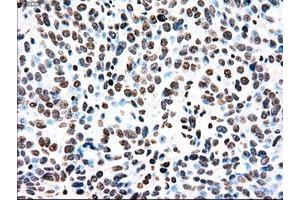 Image no. 6 for anti-TYRO3 Protein Tyrosine Kinase (TYRO3) antibody (ABIN1501605)