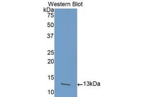 Western blot analysis of the recombinant protein. (Activin A Receptor Type IB/ALK-4 antibody  (AA 24-126))