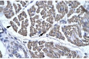 Human Skeletal Muscle; EYA3 antibody - middle region in Human Skeletal Muscle cells using Immunohistochemistry (EYA3 antibody  (Middle Region))