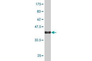 Western Blot detection against Immunogen (38. (Hemoglobin Subunit beta antibody  (AA 38-147))