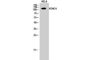 Western Blotting (WB) image for anti-Histone Deacetylase 4 (HDAC4) (Tyr493) antibody (ABIN3175468) (HDAC4 antibody  (Tyr493))