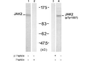 Image no. 1 for anti-Janus Kinase 2 (JAK2) (Tyr1007) antibody (ABIN319310)