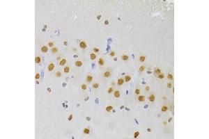 Immunohistochemistry of paraffin-embedded rat brain using HNRNPA1 Antibody (ABIN5975570) at dilution of 1/100 (40x lens). (HNRNPA1 antibody)