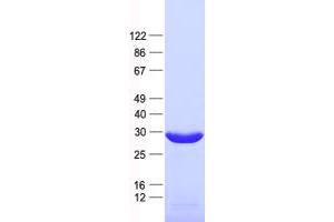 Validation with Western Blot (THAP5 Protein (His tag))