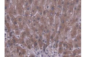 IHC-P analysis of Human Liver Tissue, with DAB staining. (CES1 antibody  (AA 18-299))