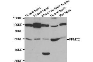 Western Blotting (WB) image for anti-Pyruvate Dehydrogenase Phosphatase (PDP) antibody (ABIN1980348) (PDP antibody)