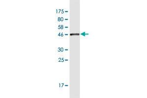 Western Blot detection against Immunogen (45. (MARCH2 antibody  (AA 1-176))
