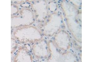 Figure. (FGF13 antibody  (AA 108-227))