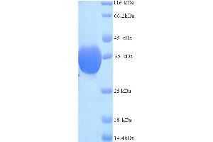 SDS-PAGE (SDS) image for Inter alpha Globulin Inhibitor H4 (ITIH4) (AA 689-930) protein (His tag) (ABIN5714320)