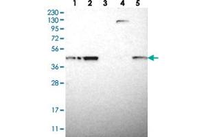 Western blot analysis of Lane 1: RT-4, Lane 2: U-251 MG, Lane 3: Human Plasma, Lane 4: Liver, Lane 5: Tonsil with TMED2 polyclonal antibody  at 1:250-1:500 dilution. (TMED2 antibody)
