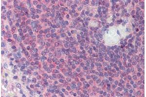 Immunohistochemistry (Paraffin-embedded Sections) (IHC (p)) image for anti-Transforming Growth Factor beta 1 Induced Transcript 1 (TGFB1I1) (N-Term) antibody (ABIN6741575)