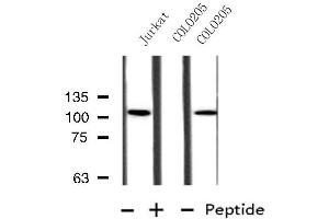 Western blot analysis of extracts from Jurkat/COLO205 cells, using MBTPS1 antibody. (MBTPS1 antibody  (Internal Region))