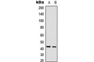 Western blot analysis of CDCA7 expression in A431 (A), U2OS (B) whole cell lysates. (CDCA7 antibody  (Center))