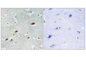 Immunohistochemistry (IHC) image for anti-K(lysine) Acetyltransferase 5 (KAT5) (Internal Region) antibody (ABIN1849868) (KAT5 antibody  (Internal Region))