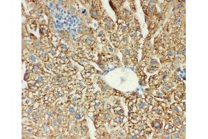Anti-MTCO1 antibody, IHC(P): Mouse Liver Tissue (COX1 antibody  (C-Term))