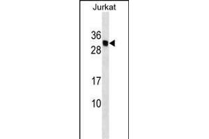 HLA-DMB Antibody (Center) (ABIN1537808 and ABIN2849547) western blot analysis in Jurkat cell line lysates (35 μg/lane). (HLA-DMB antibody  (AA 127-154))