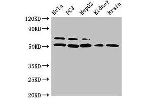 Western Blot Positive WB detected in: Hela whole cell lysate, PC-3 whole cell lysate, HepG2 whole cell lysate, Mouse kidney tissue, Mouse brain tissue All lanes: NR5A2 antibody at 3 μg/mL Secondary Goat polyclonal to rabbit IgG at 1/50000 dilution Predicted band size: 62, 57, 43, 54 kDa Observed band size: 62, 54 kDa (NR5A2 + LRH1 antibody  (AA 182-291))