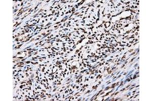 Immunohistochemical staining of paraffin-embedded Kidney tissue using anti-APP mouse monoclonal antibody. (APP antibody)