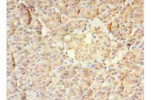 Immunohistochemistry of paraffin-embedded human pancreatic tissue using ABIN7159585 at dilution of 1:100 (MTR antibody  (AA 923-1265))