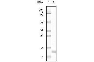 Western blot analysis using SNCG mouse mAb against truncated SNCG recombinant protein. (SNCG (Breast Cancer-Specific Protein 1) antibody)