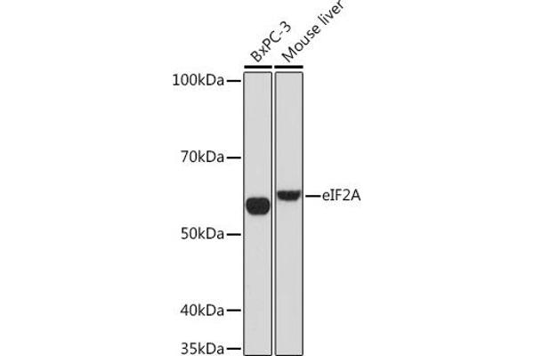 EIF2A antibody