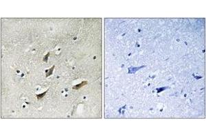 Immunohistochemistry analysis of paraffin-embedded human brain tissue, using Dematin (Ab-403) Antibody. (Dematin antibody  (AA 356-405))