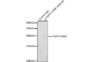 Immunoprecipitation analysis of 200 μg extracts of A-431 cells, using 3 μg Phospho-EGFR-Y1068 pAb (ABIN3020069, ABIN3020070, ABIN3020071 and ABIN6225505). (EGFR antibody  (pTyr1068))