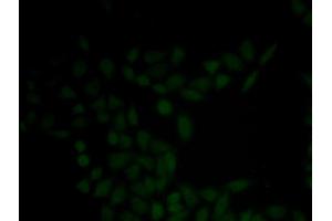 Immunofluorescence analysis of HeLa cell using KRT5 antibody (Cytokeratin 5 antibody)