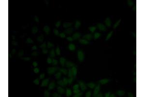 Immunofluorescence analysis of HeLa cell using KRT5 antibody (Cytokeratin 5 antibody)