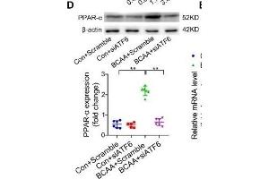 BCAA increase PPAR-α expression in a GCN2/ATF6 pathway-dependent manner.