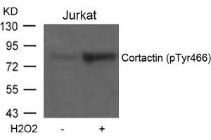 Western blot analysis of extracts from Jurkat cells untreated or treated with H2O2 using Cortactin(Phospho-Tyr466) Antibody. (Cortactin antibody  (pTyr466))
