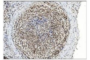 IHC analysis of SUMO2/3 using anti-SUMO2/3 antibody (ABIN7600856). (SUMO2/3 antibody  (AA 24-72))