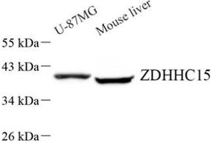 Western blot analysis of ZDHHC15 (ABIN7076280) at dilution of 1: 500 (ZDHHC15 antibody)