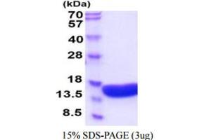 SDS-PAGE (SDS) image for Vesicle-Associated Membrane Protein 2 (Synaptobrevin 2) (VAMP2) (AA 1-94) protein (His tag) (ABIN7281268) (VAMP2 Protein (AA 1-94) (His tag))