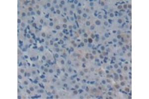 IHC-P analysis of Human Tissue, with DAB staining. (Aconitase 1 antibody  (AA 458-586))