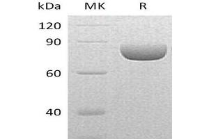 Western Blotting (WB) image for Sema Domain, Immunoglobulin Domain (Ig), Transmembrane Domain (TM) and Short Cytoplasmic Domain, (Semaphorin) 4A (Sema4a) protein (His tag) (ABIN7320641) (Sema4a Protein (His tag))