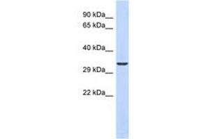 Image no. 1 for anti-Ventral Anterior Homeobox 1 (VAX1) (N-Term) antibody (ABIN6740506) (VAX1 antibody  (N-Term))