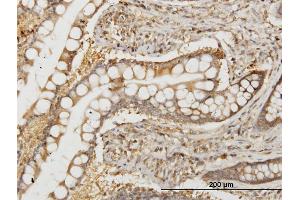 Immunoperoxidase of monoclonal antibody to NMI on formalin-fixed paraffin-embedded human small Intestine. (NMI antibody  (AA 1-100))