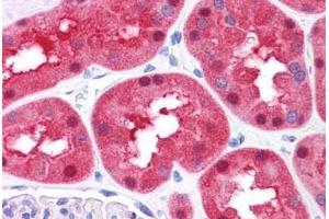Human Kidney: Formalin-Fixed, Paraffin-Embedded (FFPE) (FAH antibody  (N-Term))