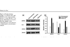 Rat brain lysates probed with Rabbit Anti-ORP150 Polyclonal Antibody (HYOU1 antibody  (AA 401-500))