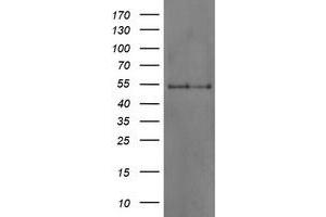 HEK293T cells were transfected with the pCMV6-ENTRY control (Left lane) or pCMV6-ENTRY DOK7 (Right lane) cDNA for 48 hrs and lysed. (DOK7 antibody)