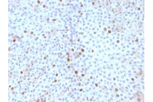 Immunohistochemistry (IHC) image for anti-Topoisomerase (DNA) II alpha 170kDa (TOP2A) (AA 1352-1493) antibody (ABIN6940773)