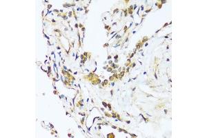 Immunohistochemistry of paraffin-embedded human lung using B antibody (ABIN7265851) at dilution of 1:100 (40x lens). (BAG3 antibody  (AA 380-575))