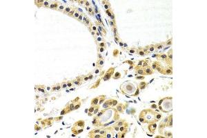 Immunohistochemistry of paraffin-embedded human thyroid using ATF2 antibody. (ATF2 antibody  (AA 1-190))