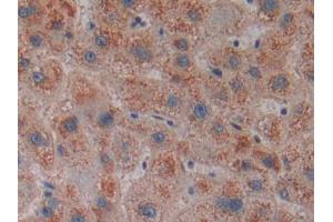 DAB staining on IHC-P; Samples: Human Liver Tissue (CENPE antibody  (AA 2450-2590))