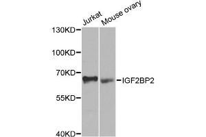 Western blot analysis of extracts of various cell lines, using IGF2BP2 antibody (ABIN5971464) at 1/1000 dilution. (IGF2BP2 antibody)